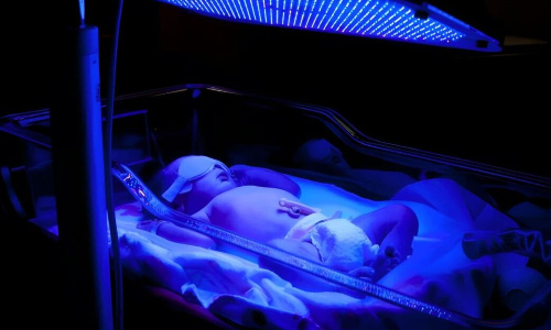 warmer and phototherapy